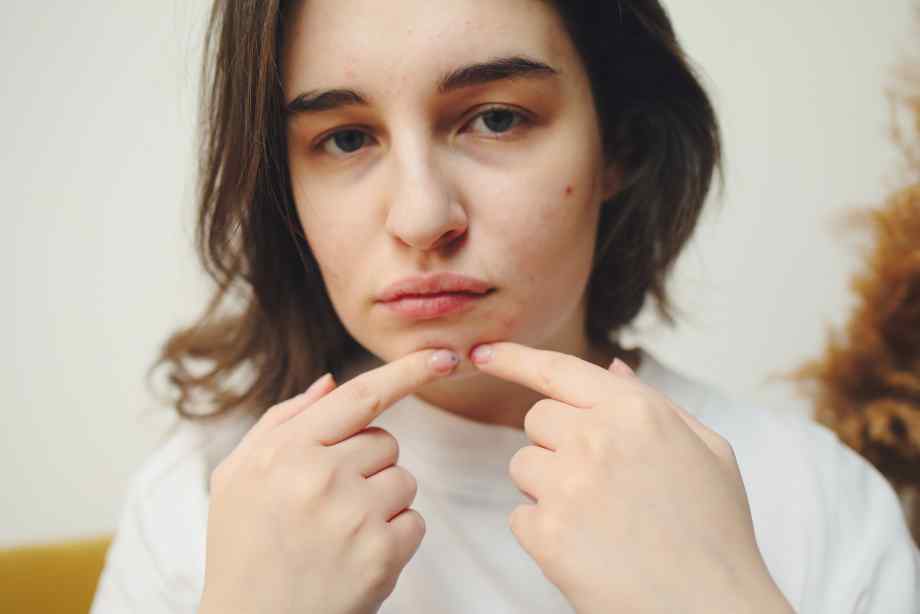 Comment reconnaître une verrue sur le visage ?-Les Fables de la Fontaine